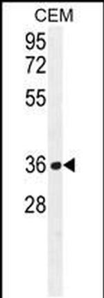 NUDT22 Antibody in Western Blot (WB)