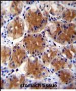 ABHD17C Antibody in Immunohistochemistry (Paraffin) (IHC (P))