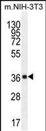 ABHD17C Antibody in Western Blot (WB)