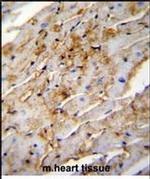 ALDH1L2 Antibody in Immunohistochemistry (Paraffin) (IHC (P))