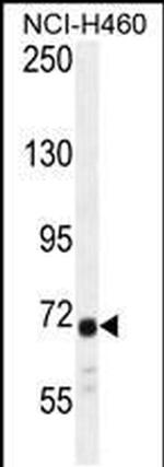ATXN7L2 Antibody in Western Blot (WB)