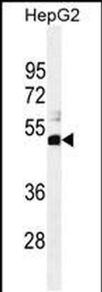 SPDYE1 Antibody in Western Blot (WB)