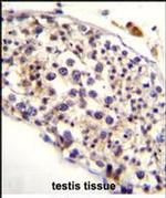 HAUS3 Antibody in Immunohistochemistry (Paraffin) (IHC (P))