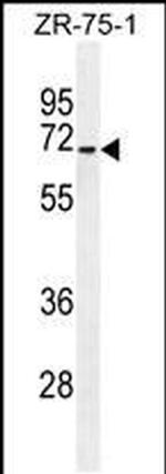 HAUS3 Antibody in Western Blot (WB)