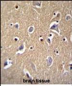 FBXO21 Antibody in Immunohistochemistry (Paraffin) (IHC (P))