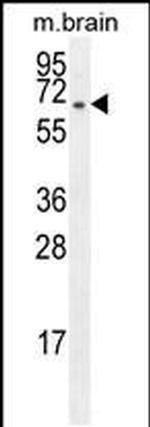 FBXO21 Antibody in Western Blot (WB)