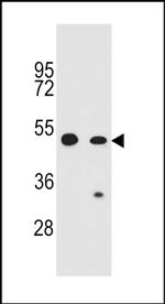 COP1 Antibody in Western Blot (WB)