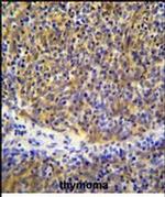 PSMB11 Antibody in Immunohistochemistry (Paraffin) (IHC (P))