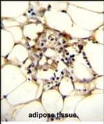 C11orf95 Antibody in Immunohistochemistry (Paraffin) (IHC (P))