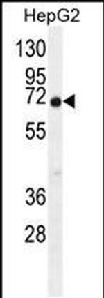 C11orf95 Antibody in Western Blot (WB)