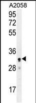 UBXN2A Antibody in Western Blot (WB)