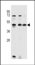 ANKRD40 Antibody in Western Blot (WB)