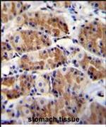 POLR3GL Antibody in Immunohistochemistry (Paraffin) (IHC (P))