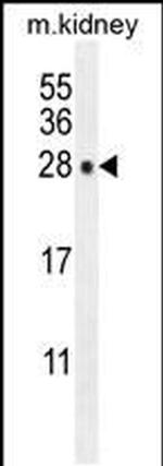 POLR3GL Antibody in Western Blot (WB)