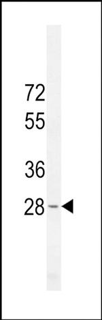 METTL10 Antibody in Western Blot (WB)
