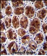 SERTAD4 Antibody in Immunohistochemistry (Paraffin) (IHC (P))