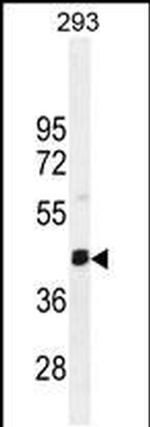 SERTAD4 Antibody in Western Blot (WB)