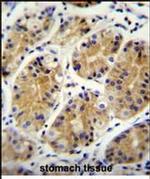 PRR22 Antibody in Immunohistochemistry (Paraffin) (IHC (P))