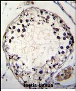 PTCHD3 Antibody in Immunohistochemistry (Paraffin) (IHC (P))