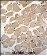 GAS2L2 Antibody in Immunohistochemistry (Paraffin) (IHC (P))