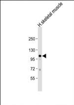 GAS2L2 Antibody in Western Blot (WB)