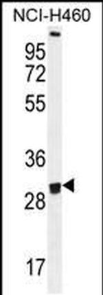 OR2B11 Antibody in Western Blot (WB)