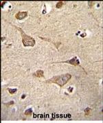 KSR2 Antibody in Immunohistochemistry (Paraffin) (IHC (P))