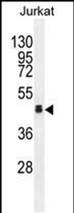 OR4N4 Antibody in Western Blot (WB)