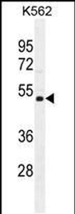 NUDT19 Antibody in Western Blot (WB)