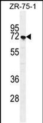 SUSD5 Antibody in Western Blot (WB)