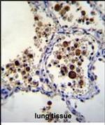 SIGLEC15 Antibody in Immunohistochemistry (Paraffin) (IHC (P))