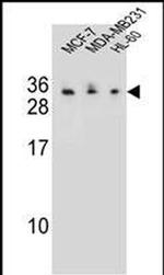 C1QL4 Antibody in Western Blot (WB)