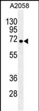 GAB4 Antibody in Western Blot (WB)