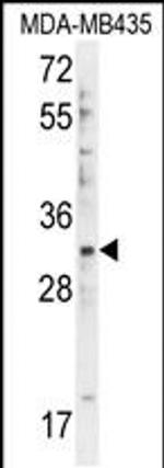 DTWD1 Antibody in Western Blot (WB)