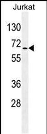 RBM14 Antibody in Western Blot (WB)