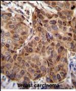 SNX24 Antibody in Immunohistochemistry (Paraffin) (IHC (P))