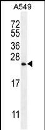 SNX24 Antibody in Western Blot (WB)