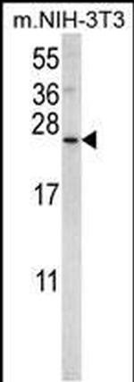 SNX24 Antibody in Western Blot (WB)