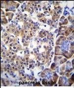 SMYD4 Antibody in Immunohistochemistry (Paraffin) (IHC (P))