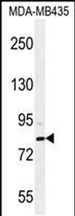SMYD4 Antibody in Western Blot (WB)