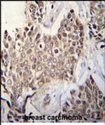 ZBTB42 Antibody in Immunohistochemistry (Paraffin) (IHC (P))