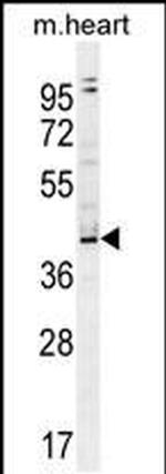 ZBTB42 Antibody in Western Blot (WB)