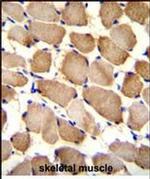 ARL17A Antibody in Immunohistochemistry (Paraffin) (IHC (P))