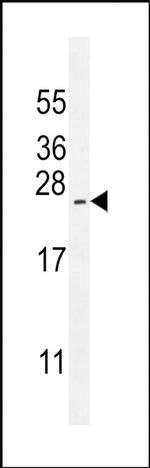 ARL17A Antibody in Western Blot (WB)
