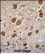 KCTD8 Antibody in Immunohistochemistry (Paraffin) (IHC (P))
