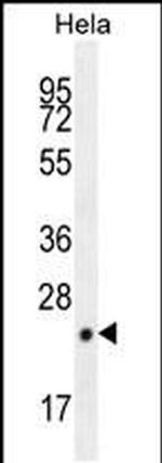 CPSF4L Antibody in Western Blot (WB)