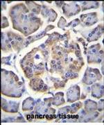 BTBD17 Antibody in Immunohistochemistry (Paraffin) (IHC (P))