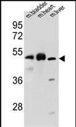 BTBD17 Antibody in Western Blot (WB)