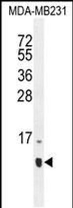 HCFC1R1 Antibody in Western Blot (WB)