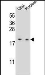 LSM7 Antibody in Western Blot (WB)